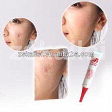 silicone scar gel natural acne scar treatment